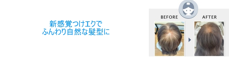 �X�L�i�P�A�V�h���T�C�g